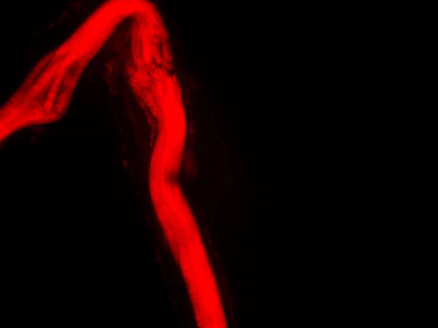 A close-up of the bacteria's filament strand