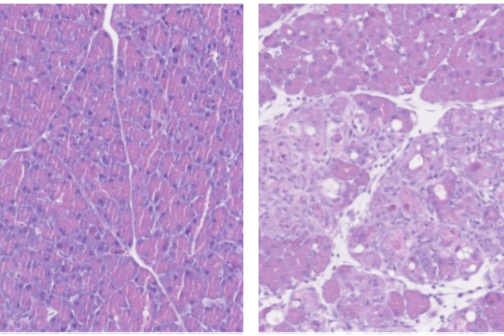 Normal pancreatic cells (left) undergo reprogramming (right) when boosted by B12