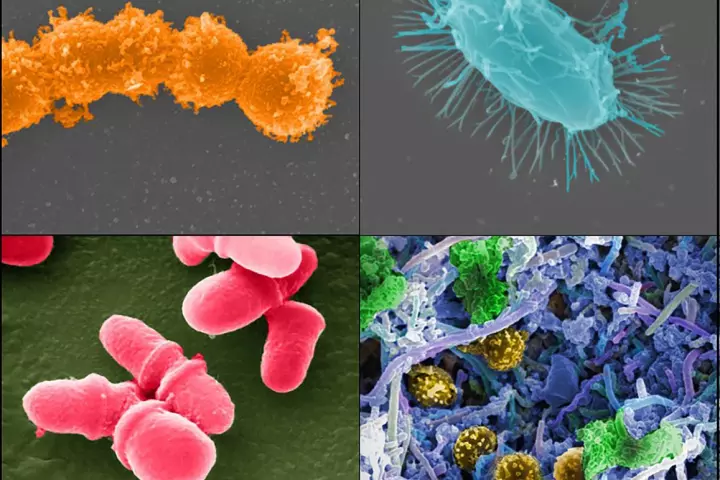 Fecal transplants may help cancer patients better deal with the harsh, gut bacteria-destroying effects of antibiotic treatments