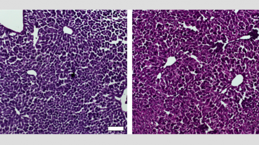 Comparison of samples of liver from control-group mice (left) and test mice (right), which received the gene-silencing treatment and as a result had reduced cholesterol levels in their livers