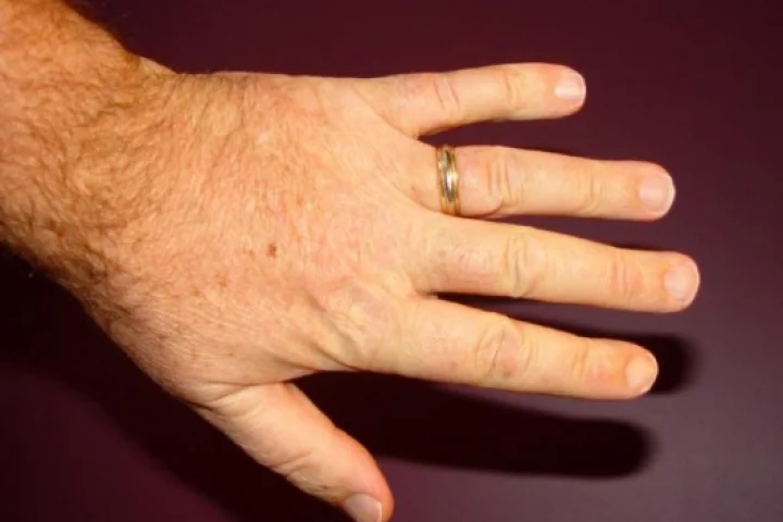 Our editor's hand - according to this study, he was probably pretty bad at maths!