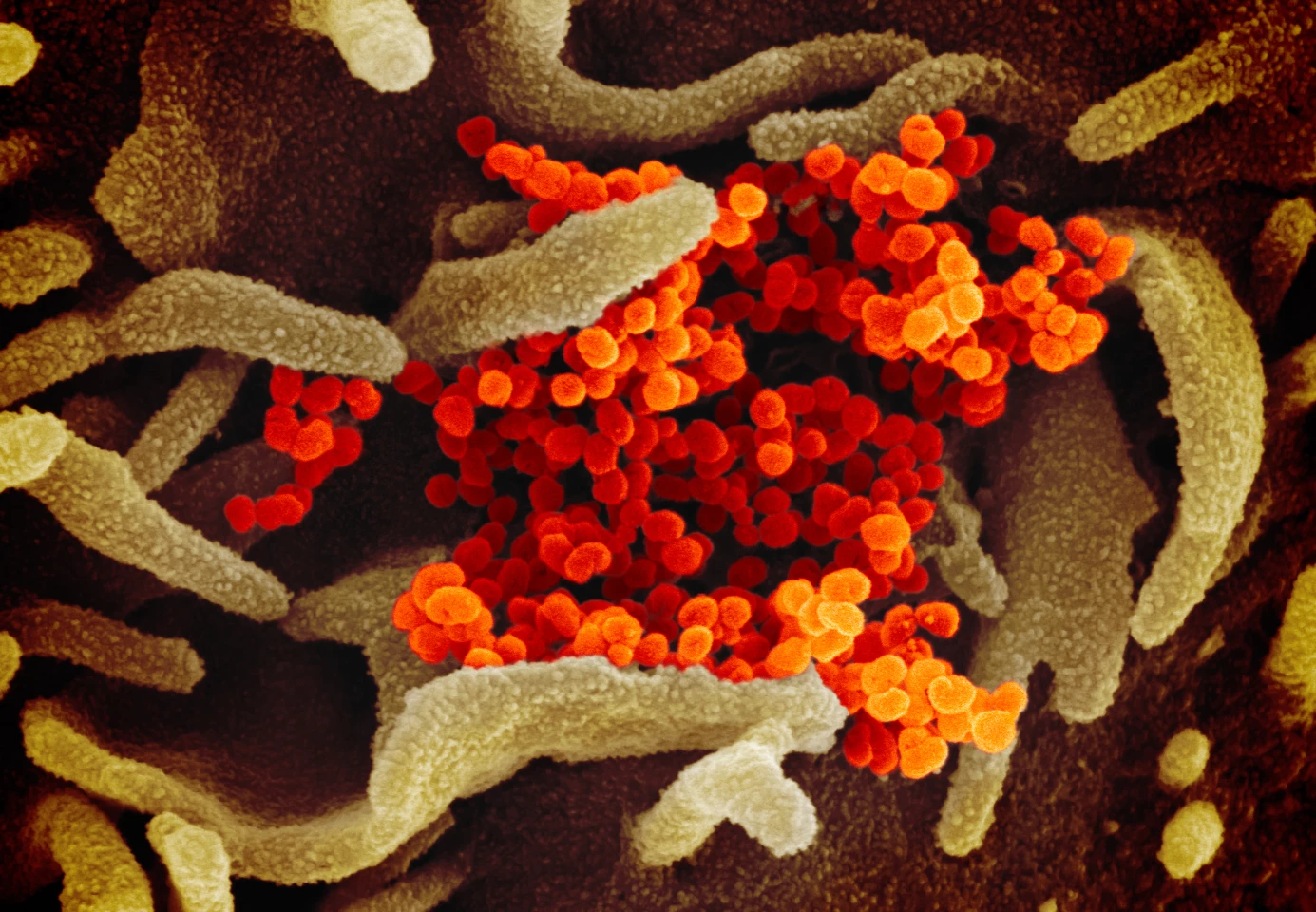 This scanning electron microscope image shows the novel coronavirus, SARS-CoV-2 (colored in orange), isolated from a patient in the U.S., emerging from the surface of cells (green) cultured in the lab