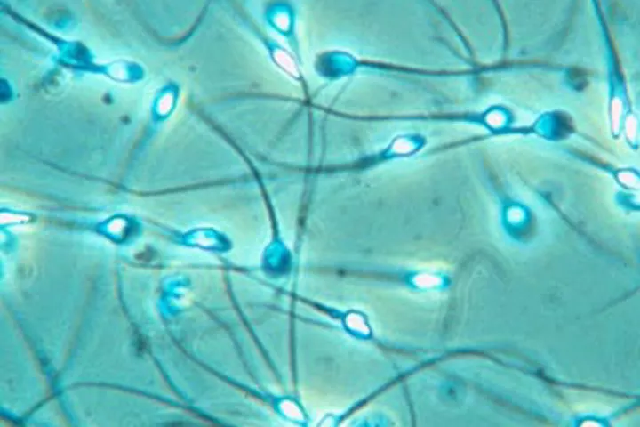 Dutch scientists develop home sperm counting device