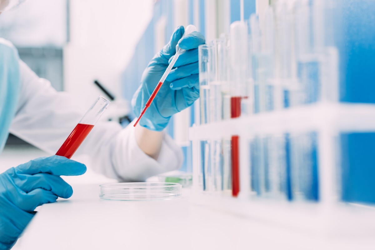 A new blood test could one day aid in the early diagnosis of Alzheimer's