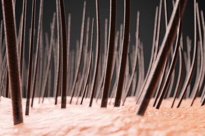 Scientists have demonstrated a new type of microneedle patch that restored hair in mouse models of baldness