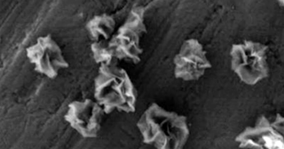 Metallic nanoflowers show promise for brain health Metallic nanoflowers show promise for brain health