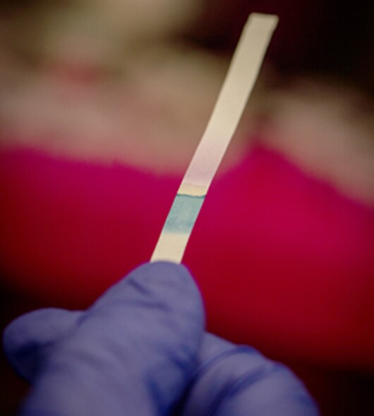 The E. coli-detecting paper strips developed at McMaster University (Photo: JD Howell)