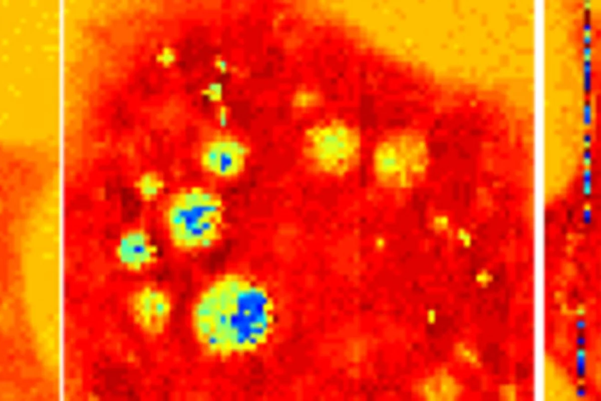A new nanoscale ultrasound technique for imaging live cells could rival the optical super-resolution techniques which won the 2014 Nobel Prize for Chemistry.