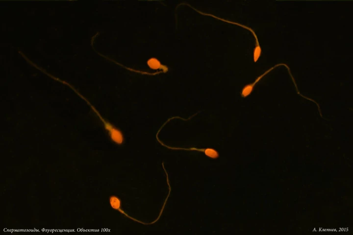 The findings may also have implications for the treatment of male infertility