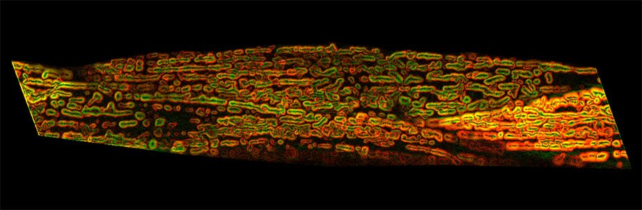 Above we can see mitochondrial cells in muscle tissue from the nematode worms