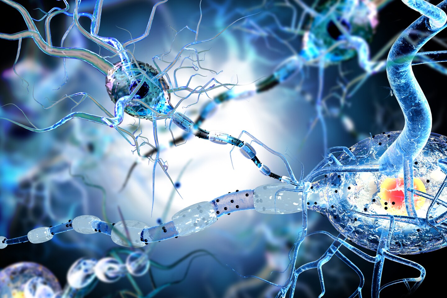 Researchers genetically engineered stem cells to generate more dopamine-producing neurons, making for more effective Parkinson's disease cell therapy