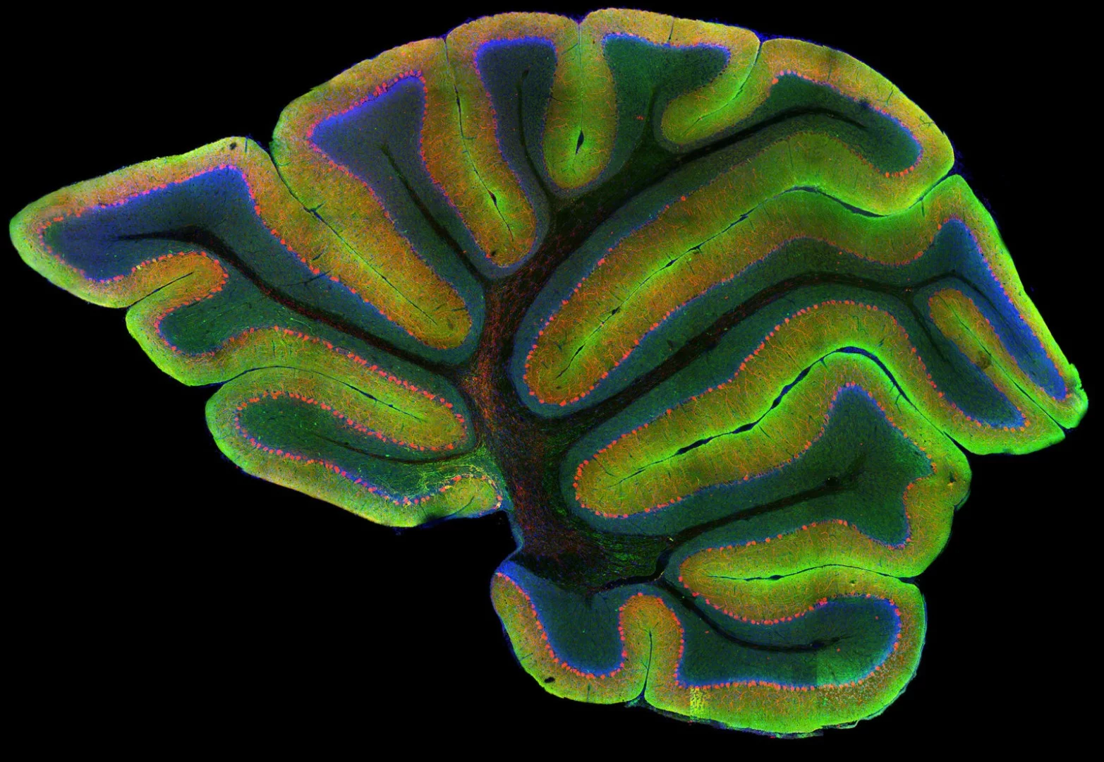 Image of Distinction: Cerebellum cells