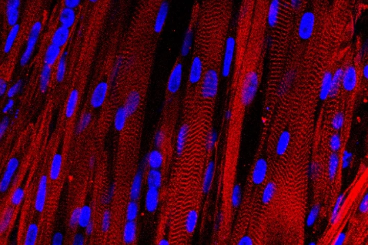 Duke University researchers claim to be the first to grow contracting human muscle tissue in a lab (Photo: Duke University)