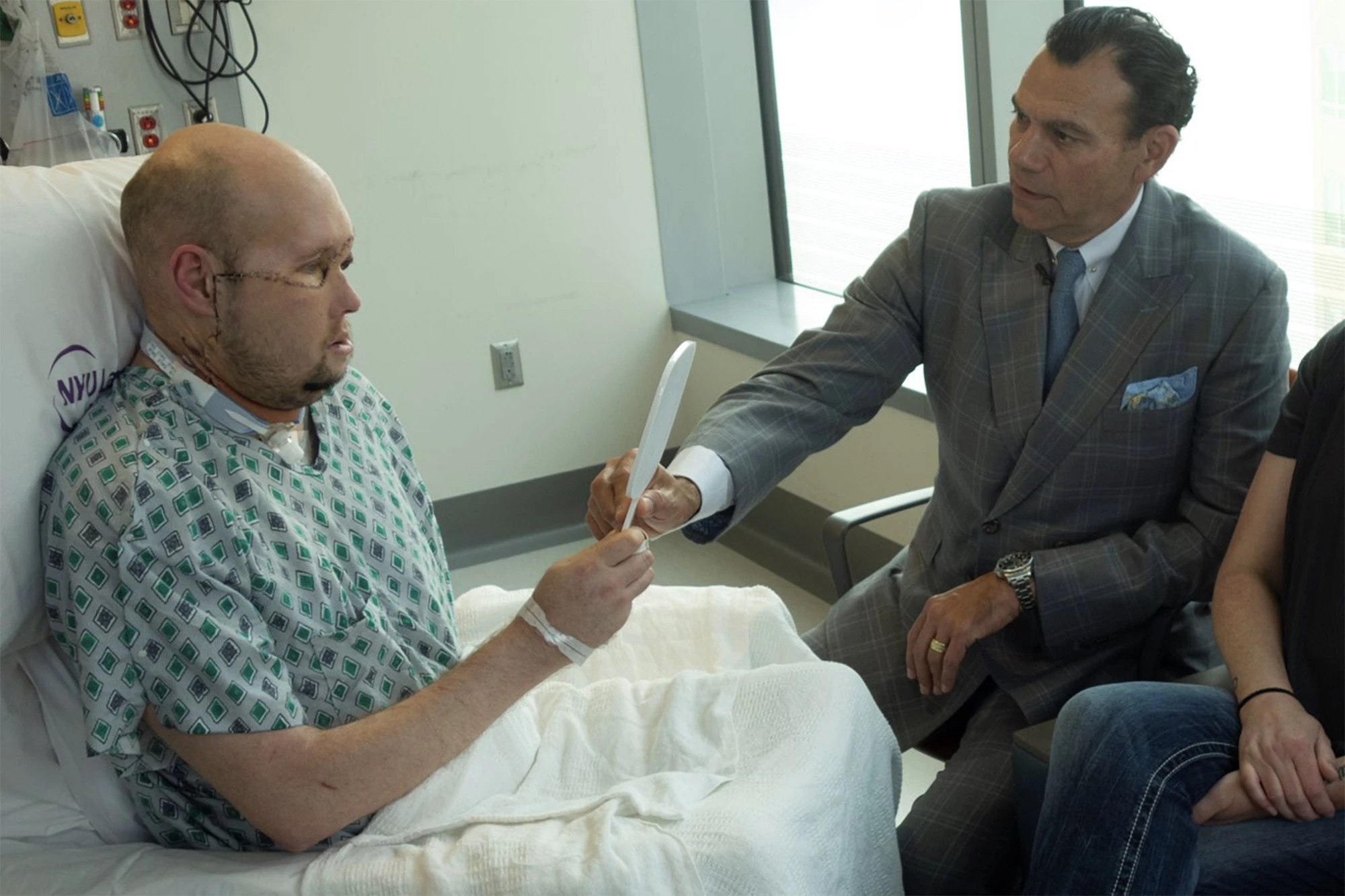 Aaron sees his transplanted face and eye for the first time