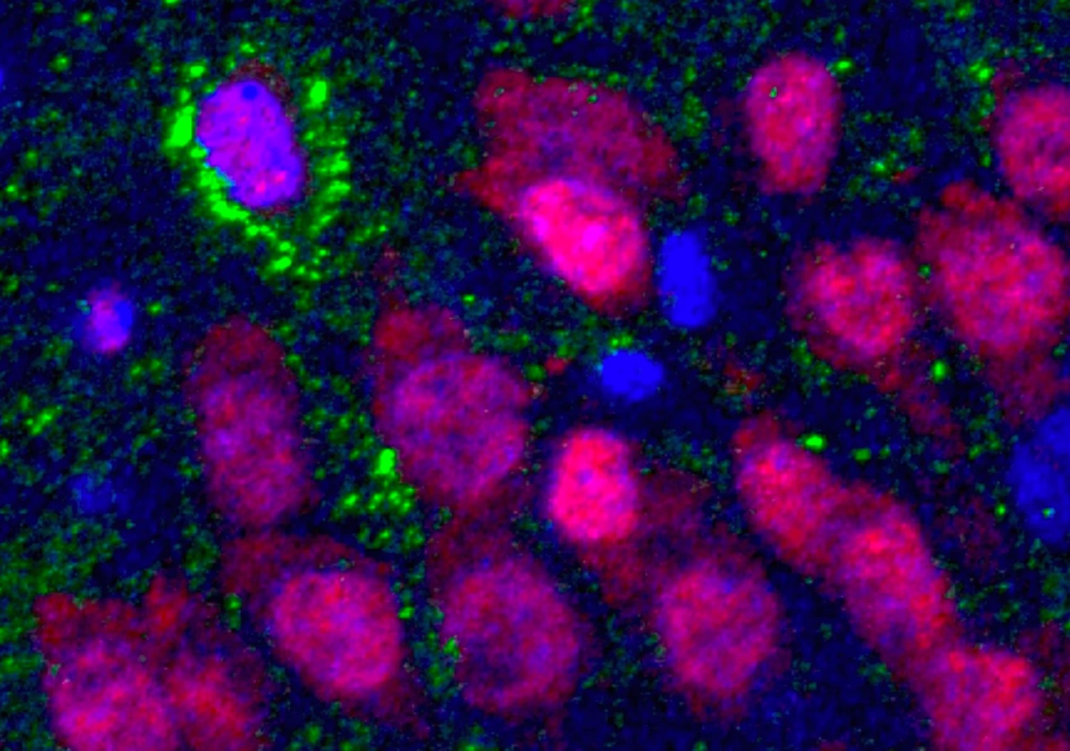 A newborn neuron (upper left) in the brain of an older adult