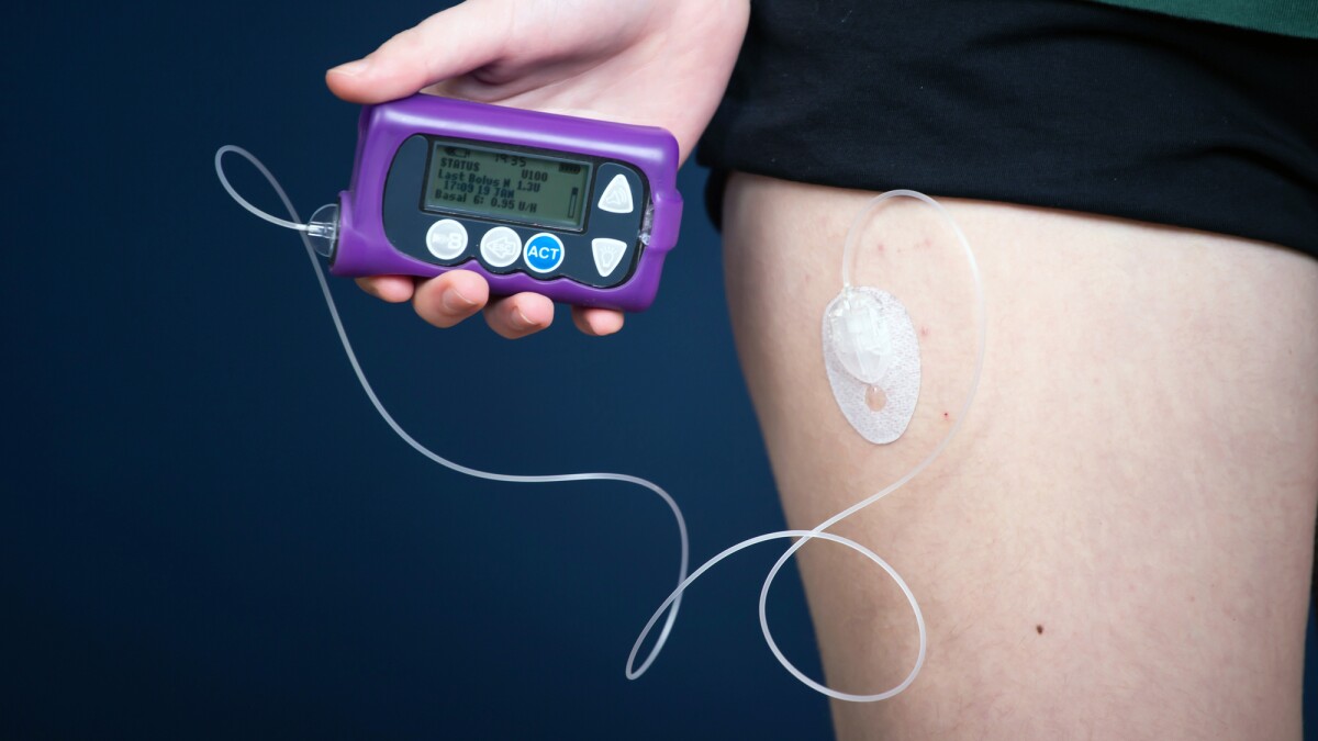 Existing drug slows progression of type 1 diabetes in newly diagnosed