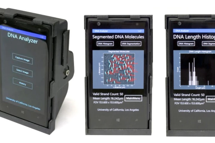A cheap smartphone attachment can resolve single strands of DNA for remote diagnostics (Photo: UCLA)