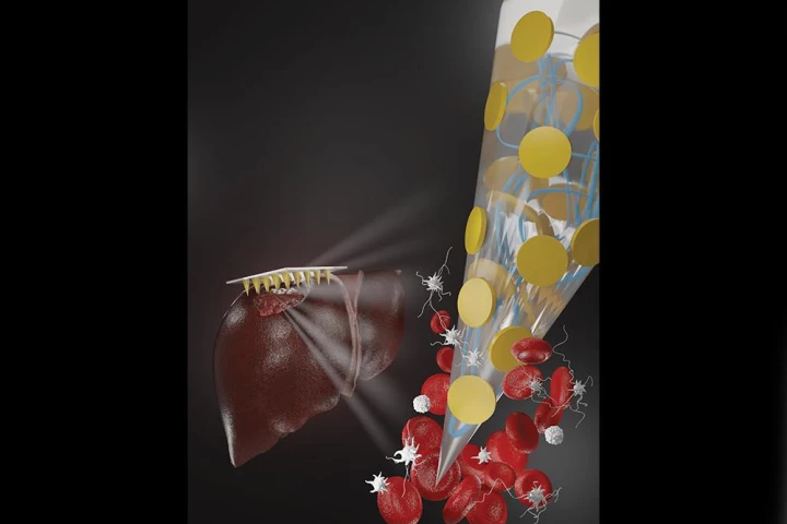This illustration shows how one of the microneedles provides more surface area for silicate nanoplatelets (gold) to come into contact with the blood