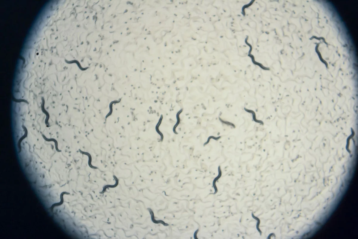 An "axis of aging" mechanism has been uncovered in the worm species C. elegans, seen here under a microscope