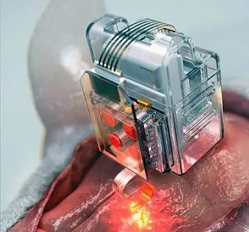 Render of KAIST's plug-and-play implant