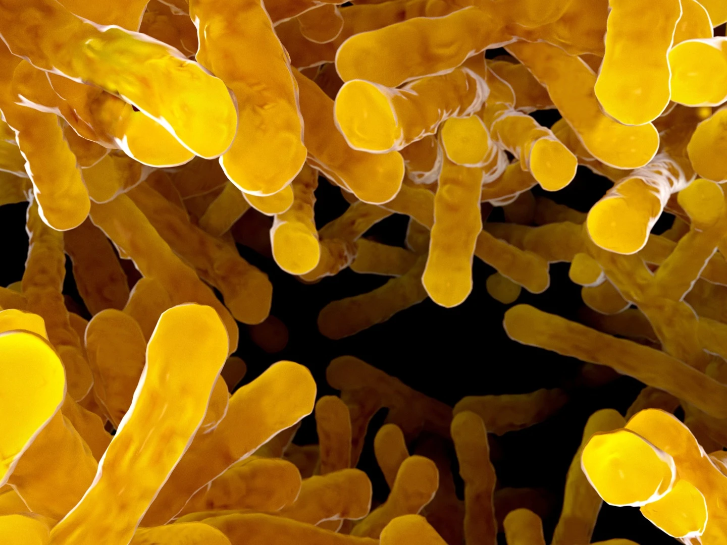 A new study describes how the primary drug treatment for Parkinson's disease can be metabolized in the gut by a certain bacteria, reducing its overall efficacy and potentially increasing the chances of negative side effects