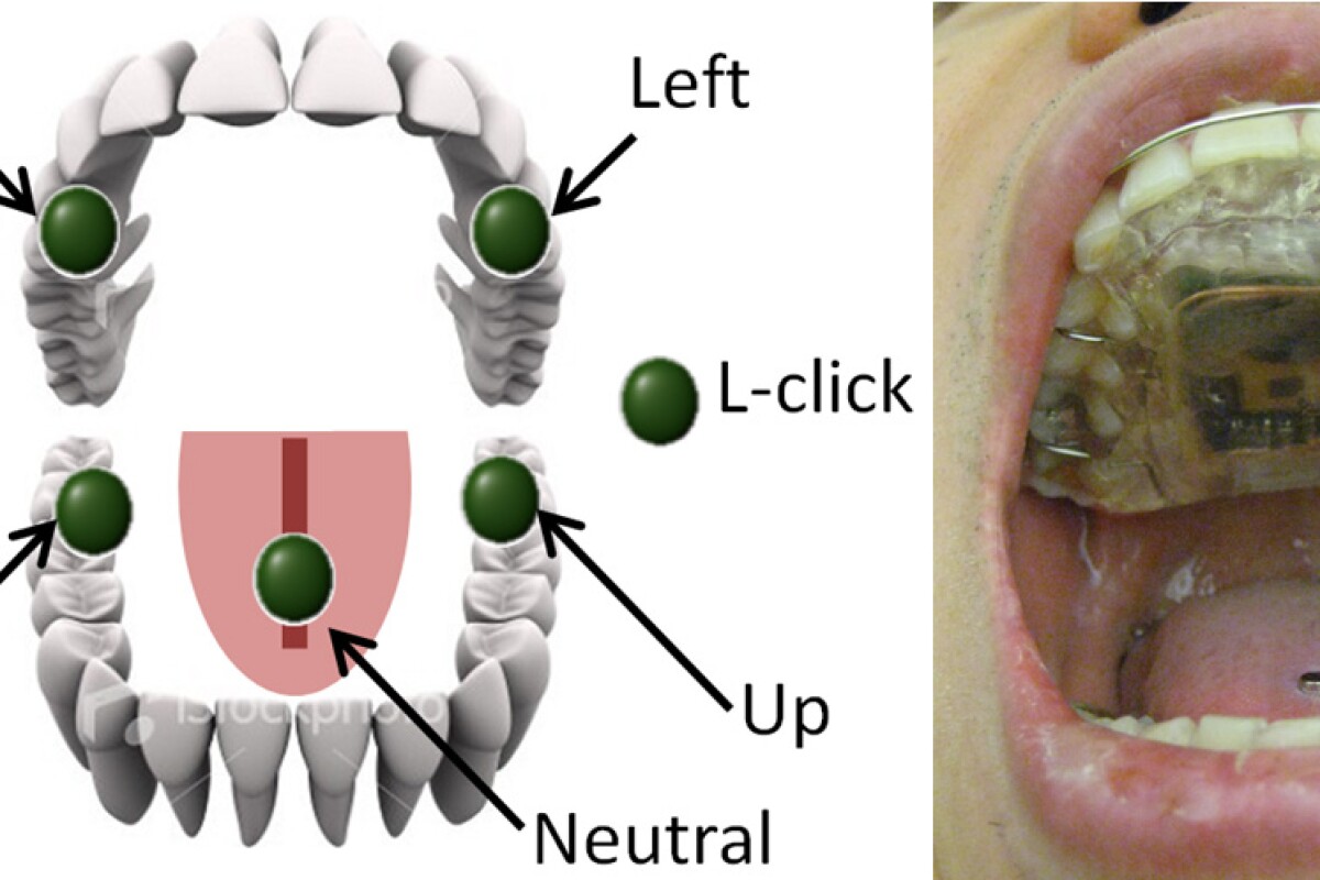 New tech allows quadriplegics to discreetly control wheelchairs using