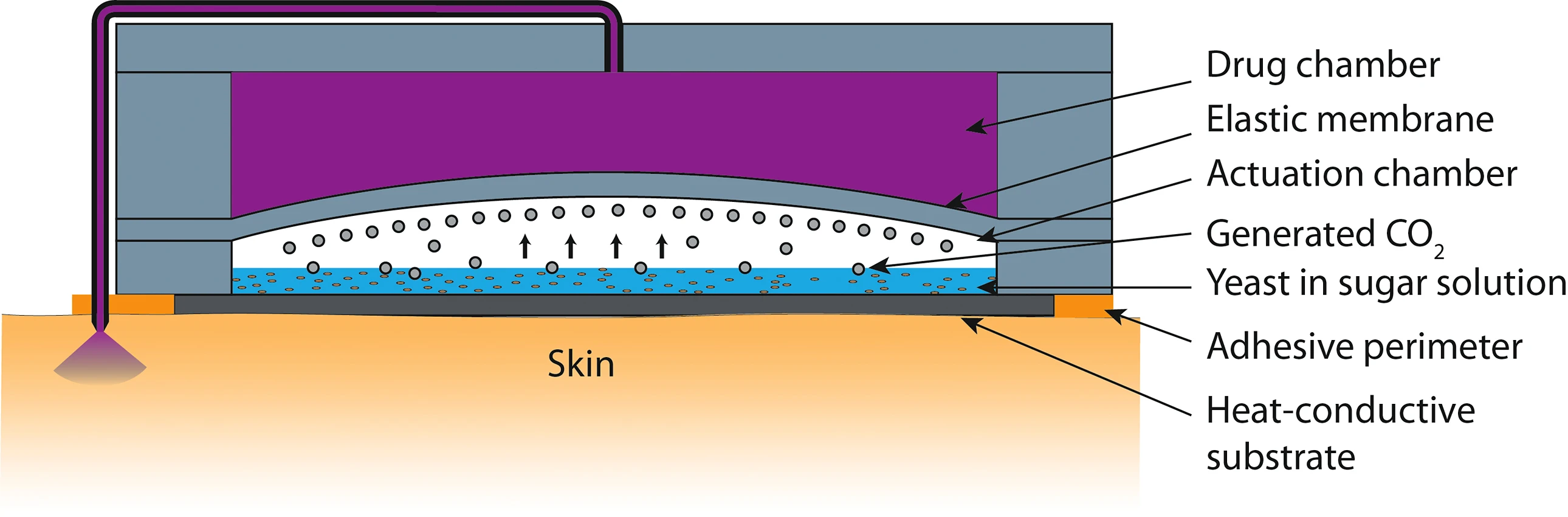A diagram of Purdue's transdermal microneedle patch