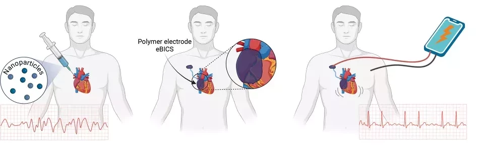 A diagram illustrating how the new injectable pacemaker would work