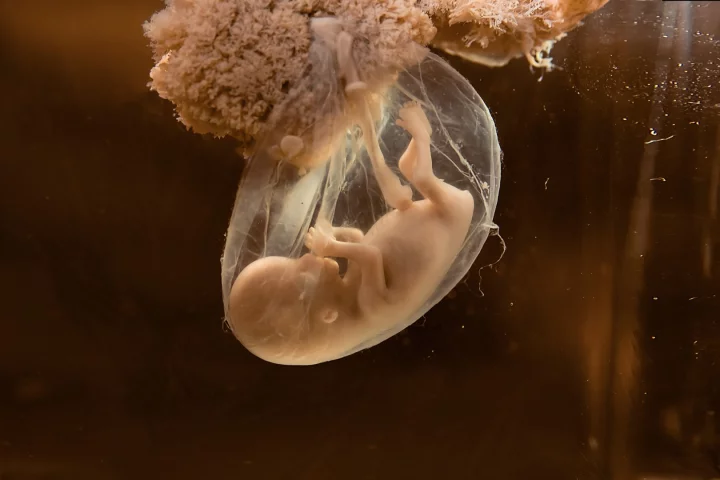 Are c-section births shaping human evolution?