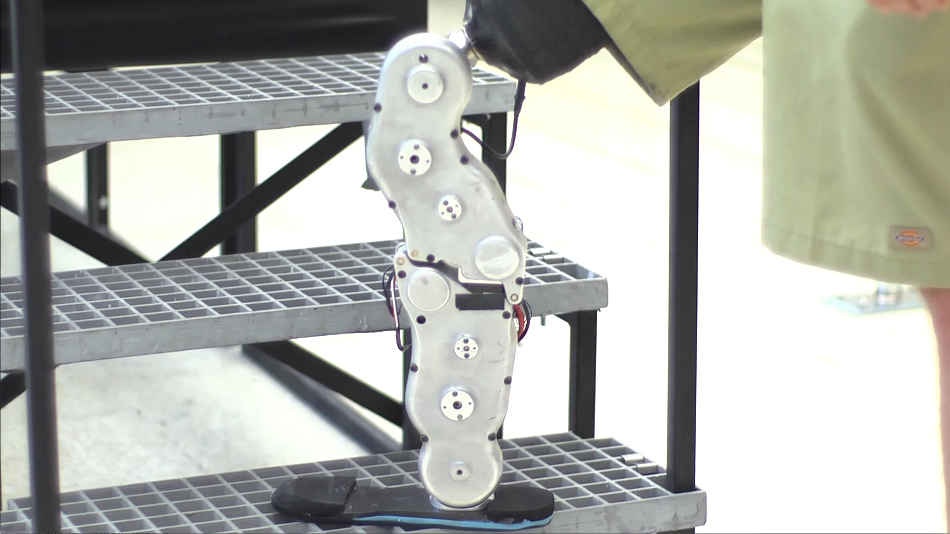 The bionic leg interprets nerve impulses detected by electrodes attached to the skin
