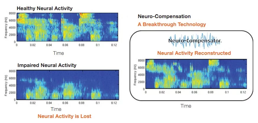 Diagram showing how the Neural-Compensator technology works