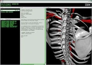 IBM medical visualization software that lets doctors search specific parts of the body