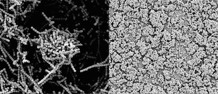 On the left is a colony of strep bacteria, which clumps together to form a protective biofilm; on the right is a close up of that biofilm breaking down when exposed to human breast milk sugars