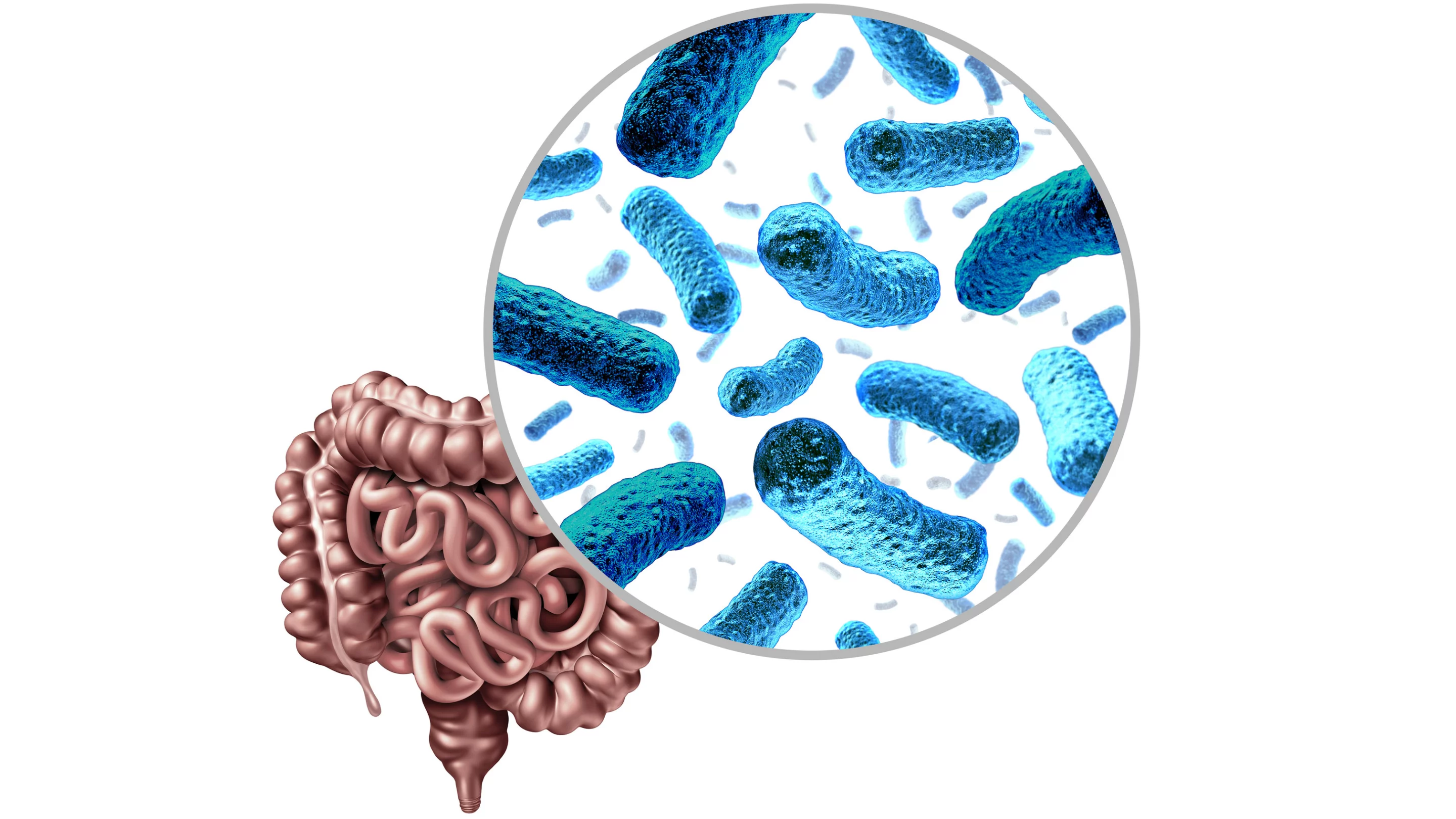 The research reports a novel link between the gut microbiome and prostate cancer