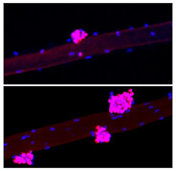 A comparison between a control group (top) and the experimental group (bottom), which received Yamanaka factors in the muscle fiber. The pink blobs represent a muscle stem cell marker called Pax7