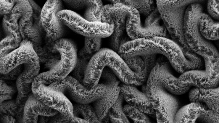 When carbon nanotube forests are placed on an elastomer substrate pre-stretched in two directions, it creates a maze of spaghetti instead of rows, improving the stretchable supercapacitor’s performance