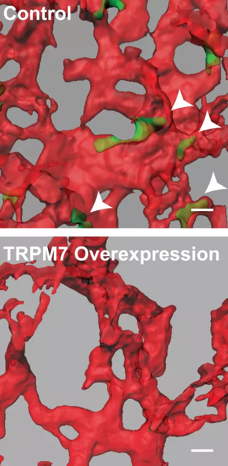 Reducing the expression of the protein TRPM7 in cancer cells reduces the number that move into blood vessels