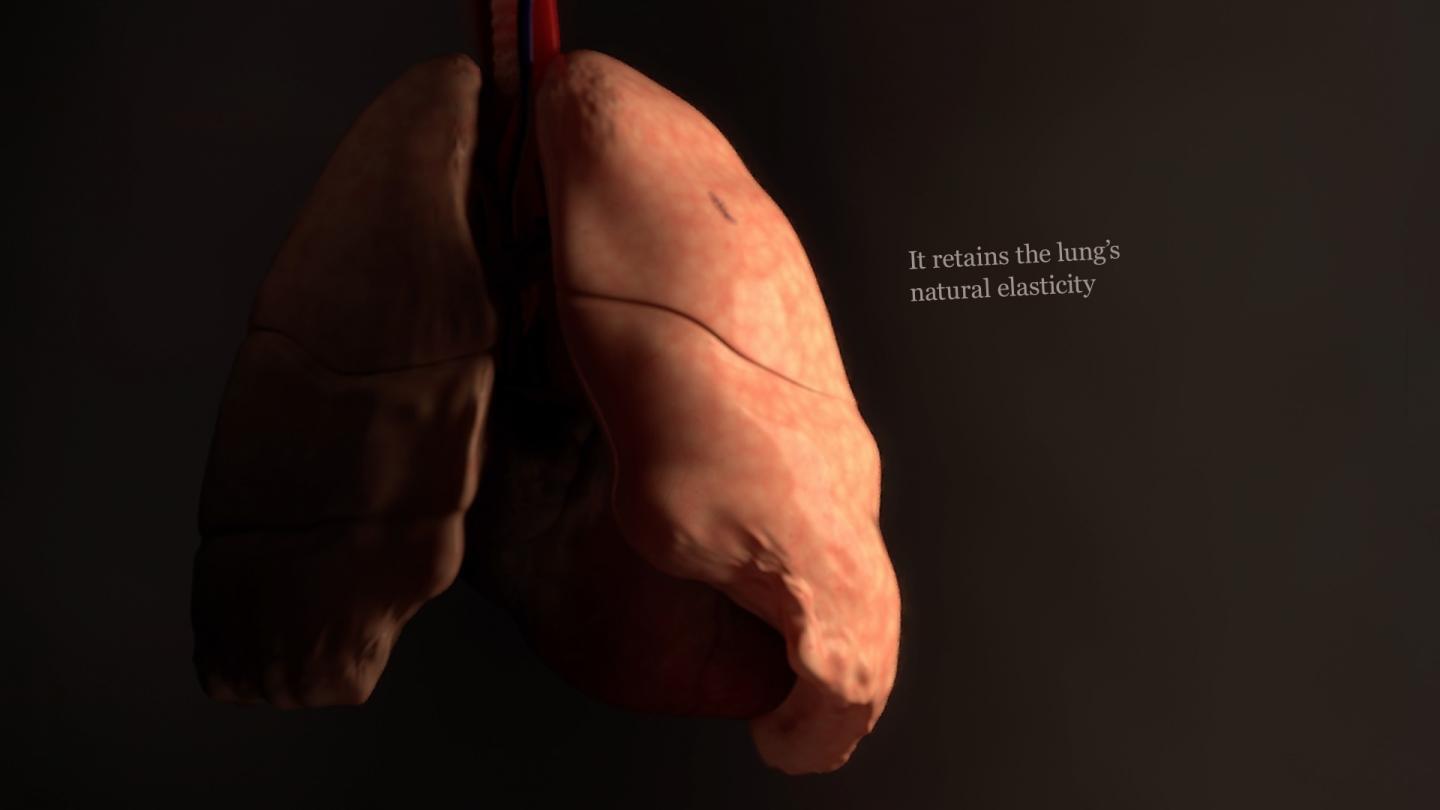 The MeTro glue is highly elastic, allowing the tissue it interacts with to maintain its elasticity as well