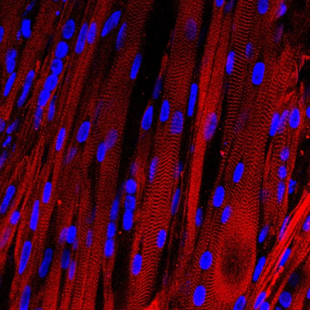 Duke University researchers claim to be the first to grow contracting human muscle tissue in a lab (Photo: Duke University)