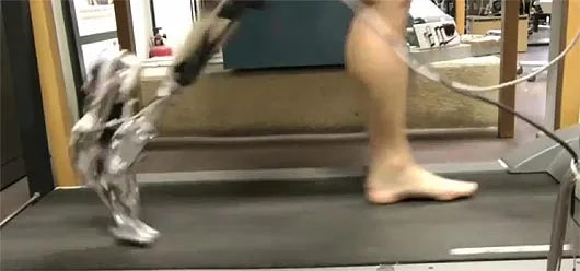 An amputee tests the AMP-Foot 2.0 on a treadmill