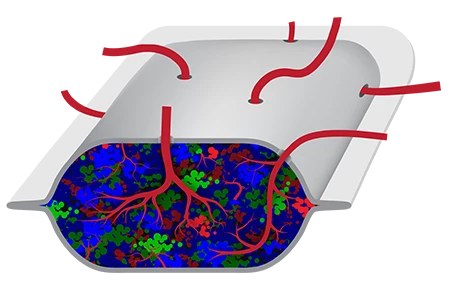 An artist's impression of the ViaCyte delivery device