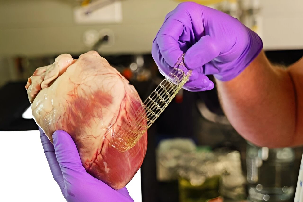 The new hydrogel is flexible enough to conform to the heart muscle, but strong enough to take a "beating"