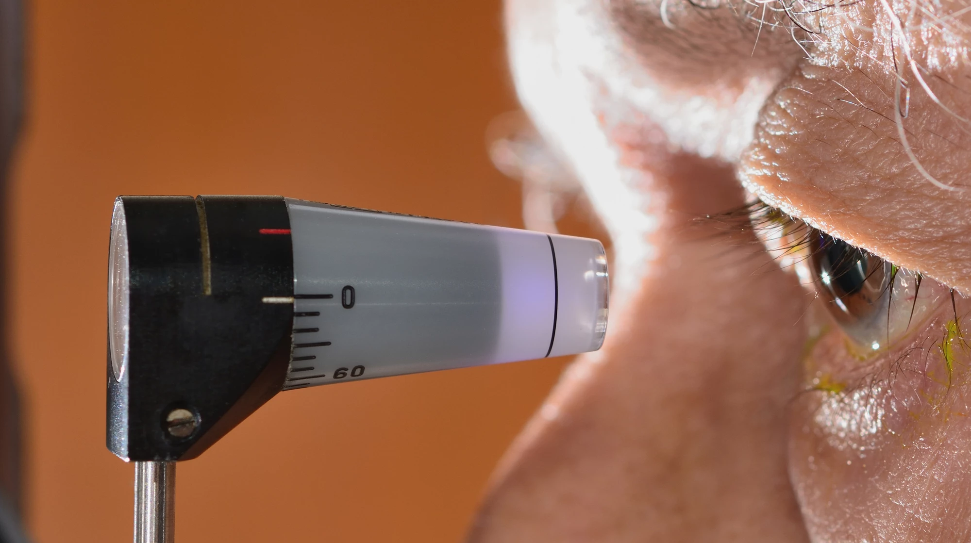 A new study shows that removal of or incisions in a membrane in the eye could improve glaucoma treatments