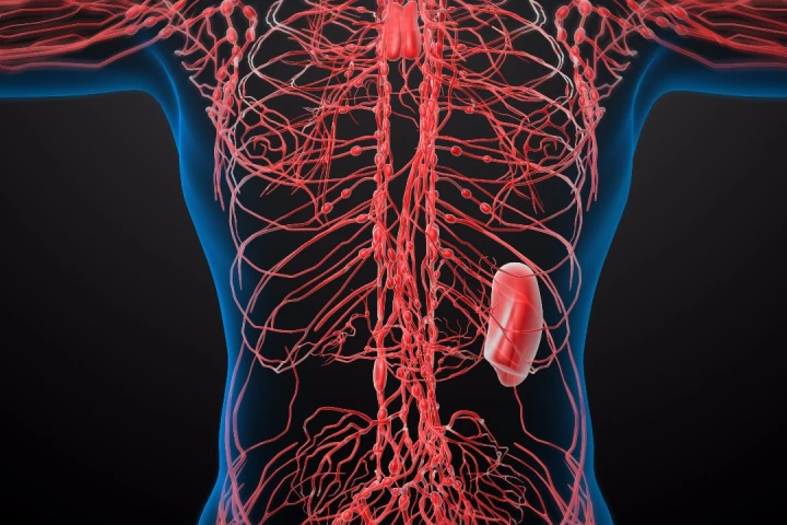 The treatment shows promise for lowering the number of melanoma cells in the lymphatic system