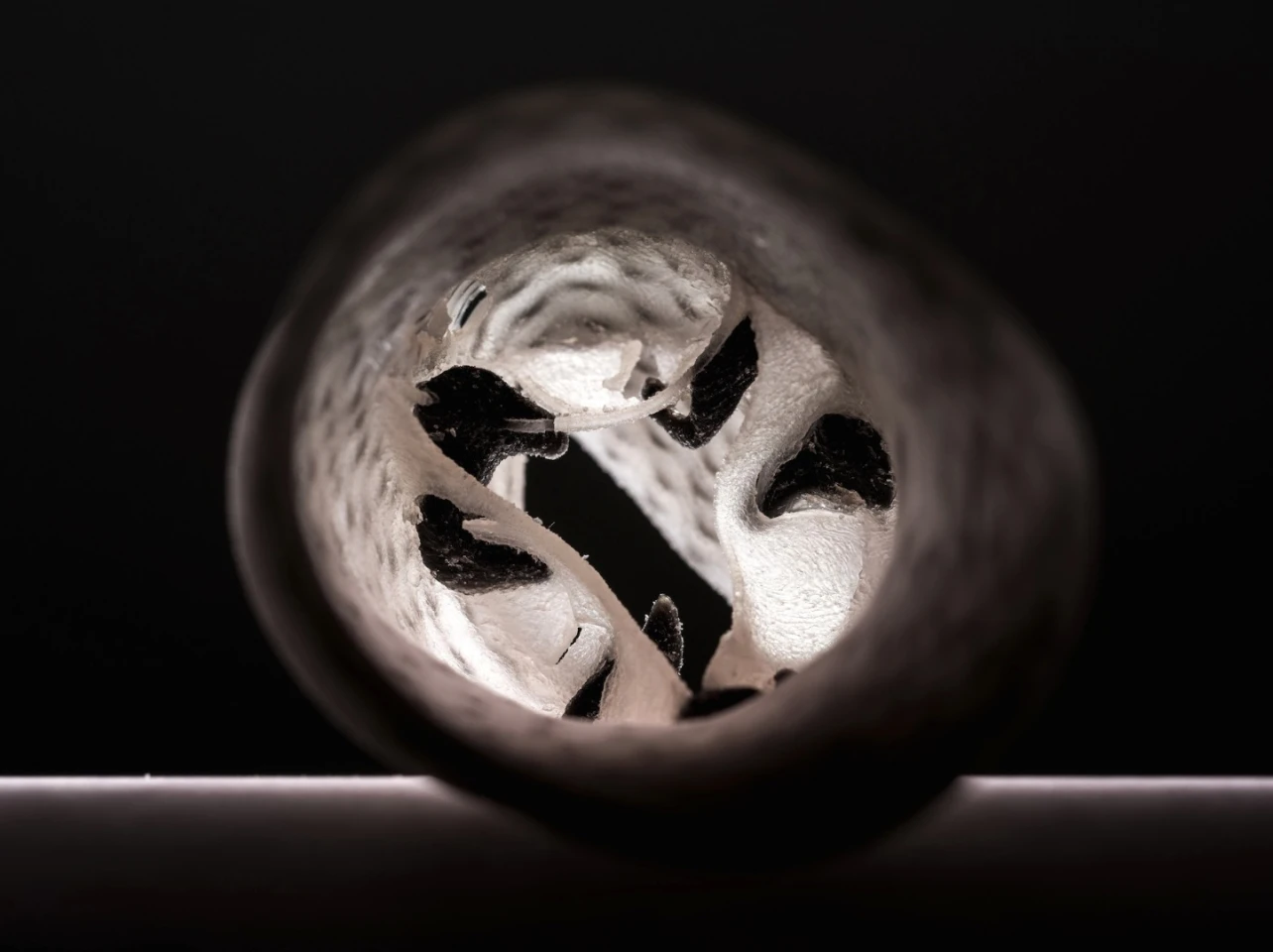 The 3D printed heart valves can be recreate in great detail what's happening inside a patient: the black areas represent calcium deposits in the valve