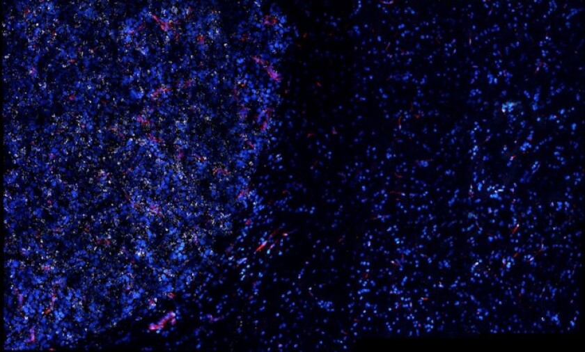 Golden nanostars, seen here as white dots, tend to accumulate in tumors (left), and not as much in healthy tissue (right), allowing researchers to target their attacks more precisely