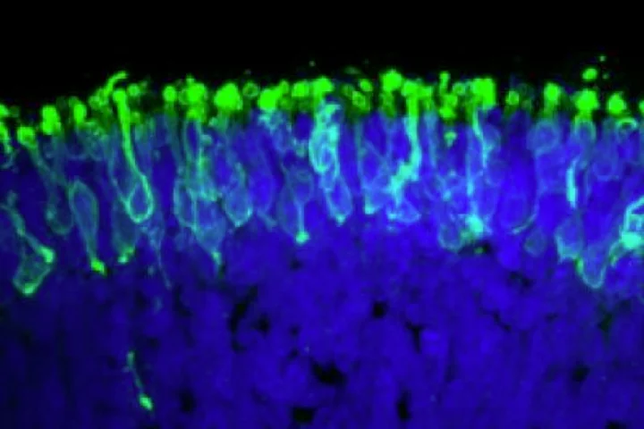 Rod photoreceptors (in green) within a "mini retina" derived from human iPS cells in the lab (Photo: Johns Hopkins)