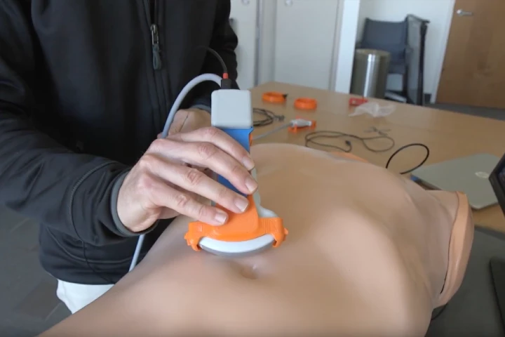 Consisting of a $10 microchip this device makes existing 2D ultrasound devices capable of producing 3D images