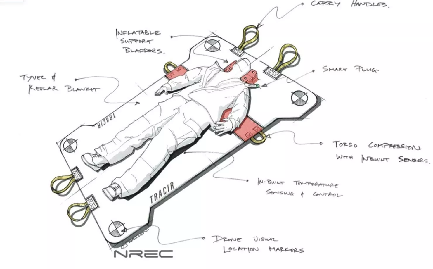 Concept sketch of the TRAuma Care In a Rucksack (TRACIR) system