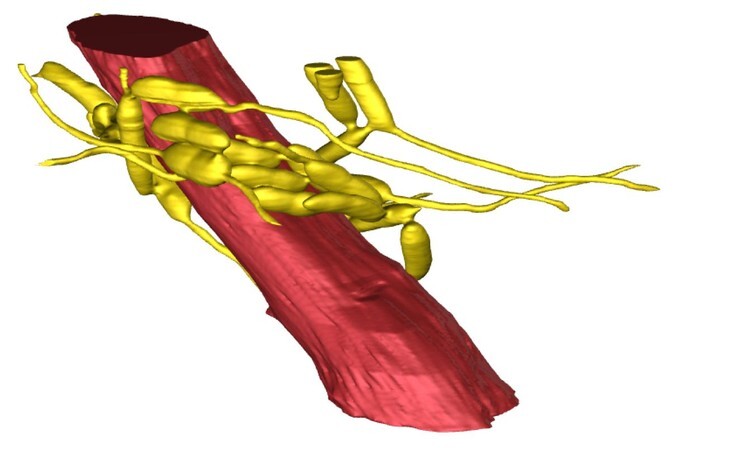 A 3D reconstruction of an ant mandible muscle (red) surrounded by fungal cells (yellow)
